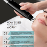 Small Area - Nitrogen Plasma Skin Rejuvenation